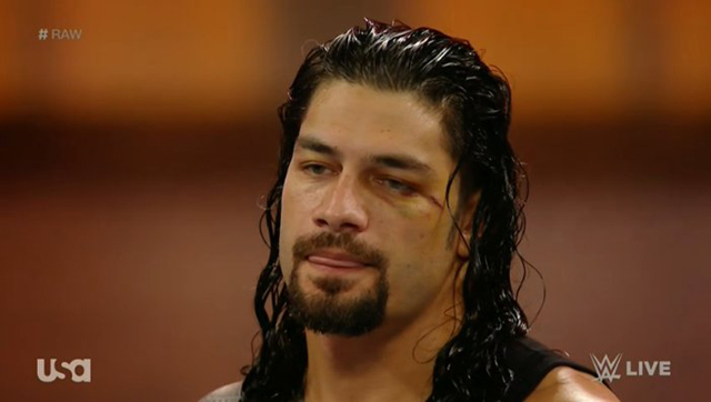 Roman Reigns