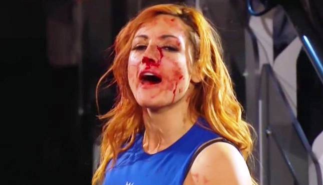 Becky Lynch Bloodied