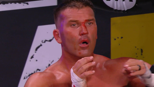 SCU Break Up As Tag Team Following AEW Tag Team Title Match Loss on Dynamite - Vimarsana News